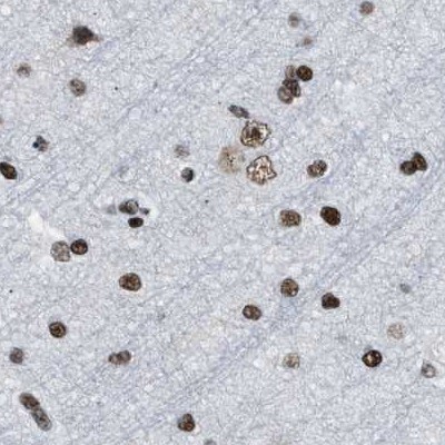 SFRS15 Antibody - BSA Free Immunohistochemistry-Paraffin: SFRS15 Antibody [NBP1-88002]
