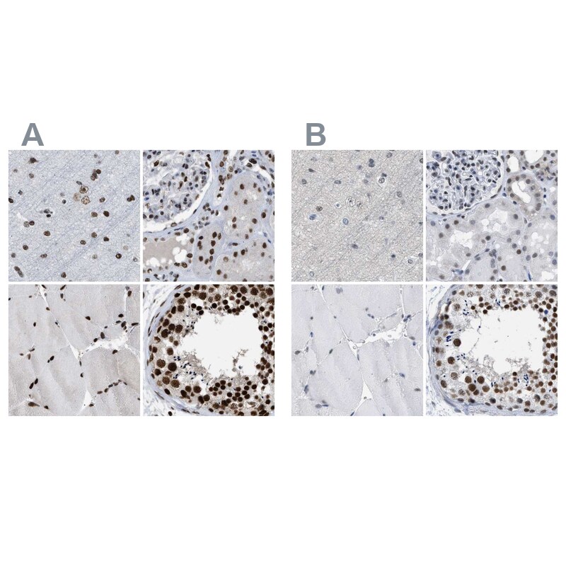 SFRS15 Antibody - BSA Free Immunohistochemistry-Paraffin: SFRS15 Antibody [NBP1-88002]