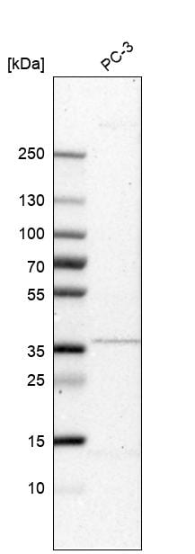 MGC16471 Antibody - BSA Free Western Blot: MGC16471 Antibody - BSA Free [NBP1-88005]