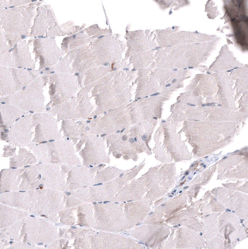 SGEF Antibody - BSA Free Immunohistochemistry-Paraffin: SGEF Antibody - BSA Free [NBP1-88006]