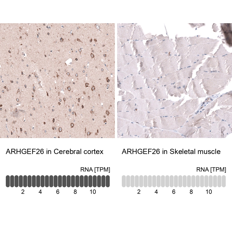 SGEF Antibody - BSA Free Immunohistochemistry-Paraffin: SGEF Antibody - BSA Free [NBP1-88006]