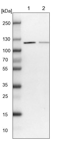 VPS50 Antibody - BSA Free Western Blot: VPS50 Antibody - BSA Free [NBP1-88012]