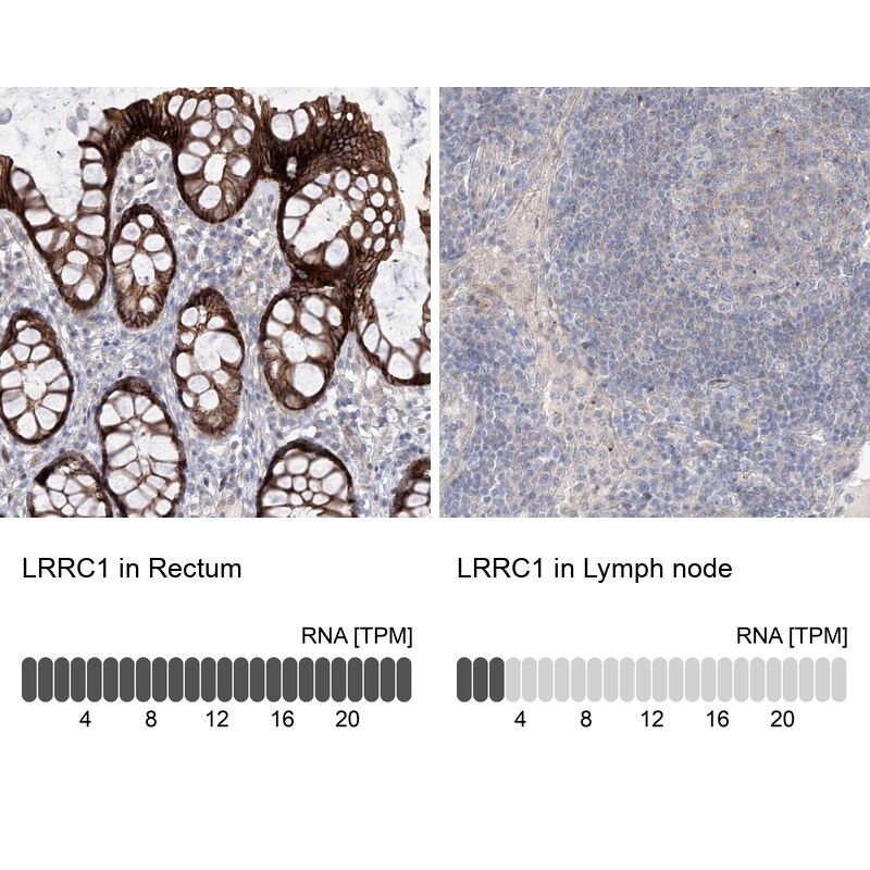 Lano Antibody - BSA Free Immunohistochemistry-Paraffin: Lano Antibody - BSA Free [NBP1-88016]