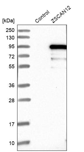 ZNF96 Antibody - BSA Free Western Blot: ZNF96 Antibody - BSA Free [NBP1-88018]