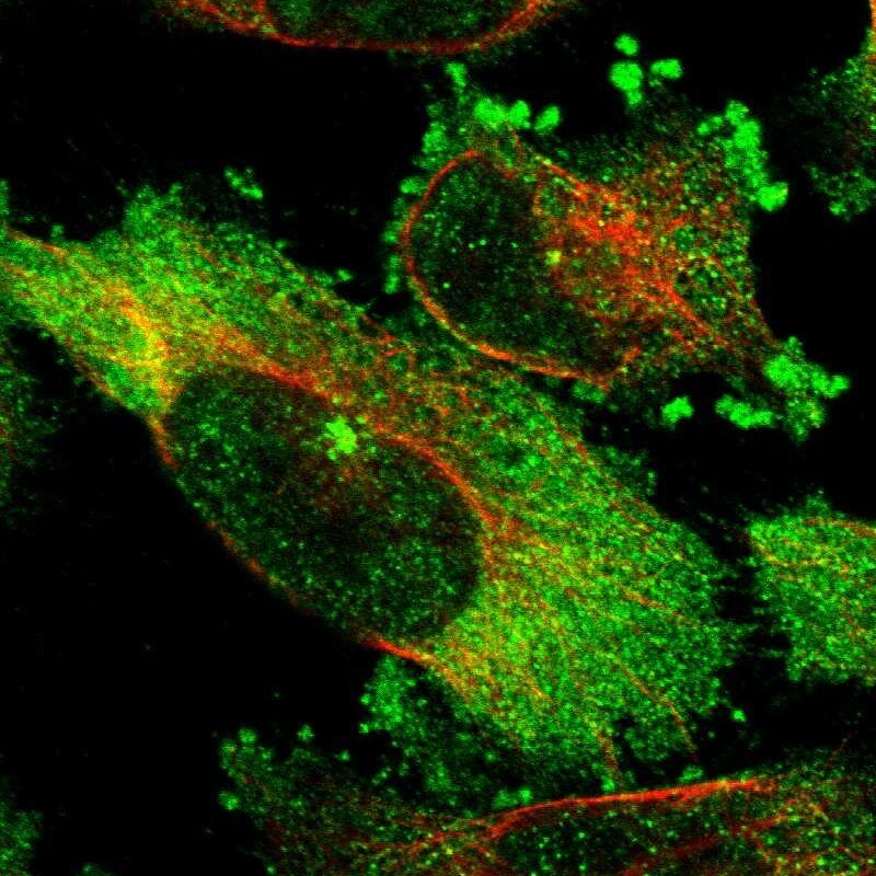 FAM29A Antibody - BSA Free Immunocytochemistry/ Immunofluorescence: FAM29A Antibody [NBP1-88022]