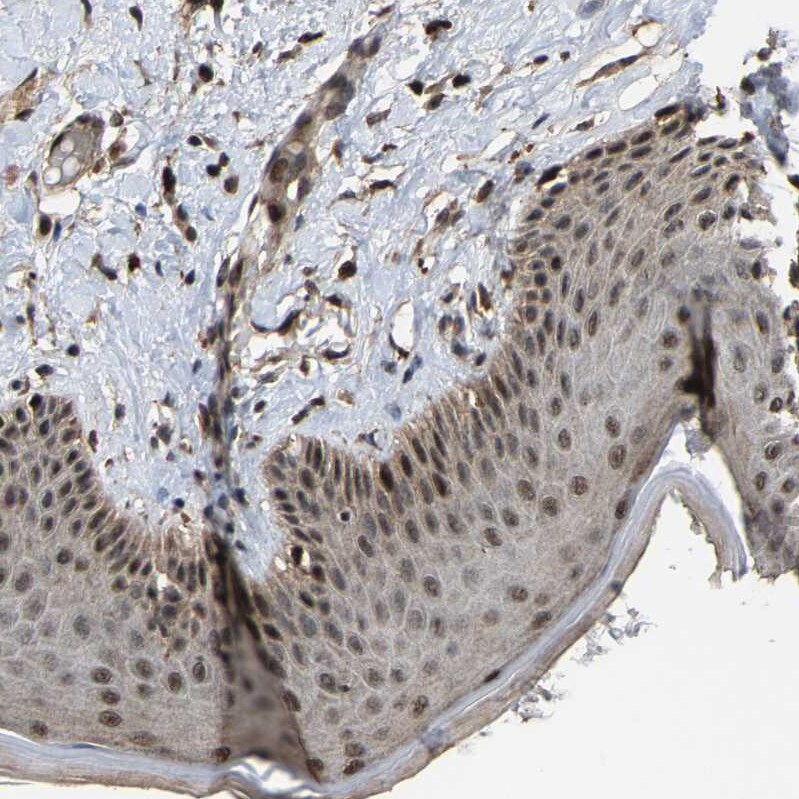 FAM29A Antibody - BSA Free Immunohistochemistry-Paraffin: FAM29A Antibody - BSA Free [NBP1-88022]