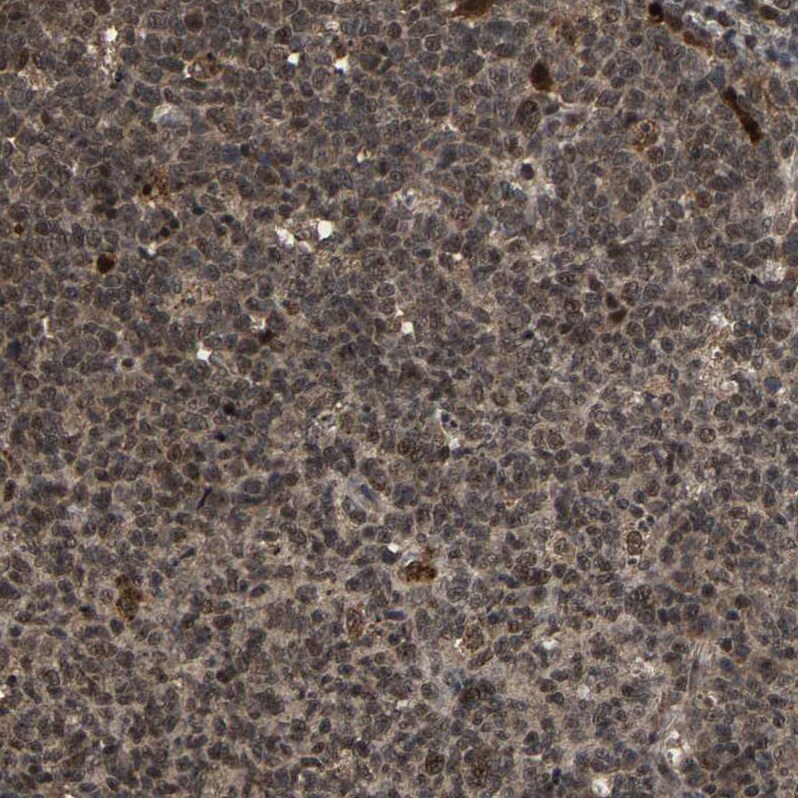 FAM29A Antibody - BSA Free Immunohistochemistry-Paraffin: FAM29A Antibody - BSA Free [NBP1-88022]