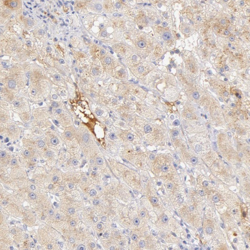 Vitamin D BP Antibody - BSA Free Immunohistochemistry-Paraffin: Vitamin D BP Antibody [NBP1-88028]