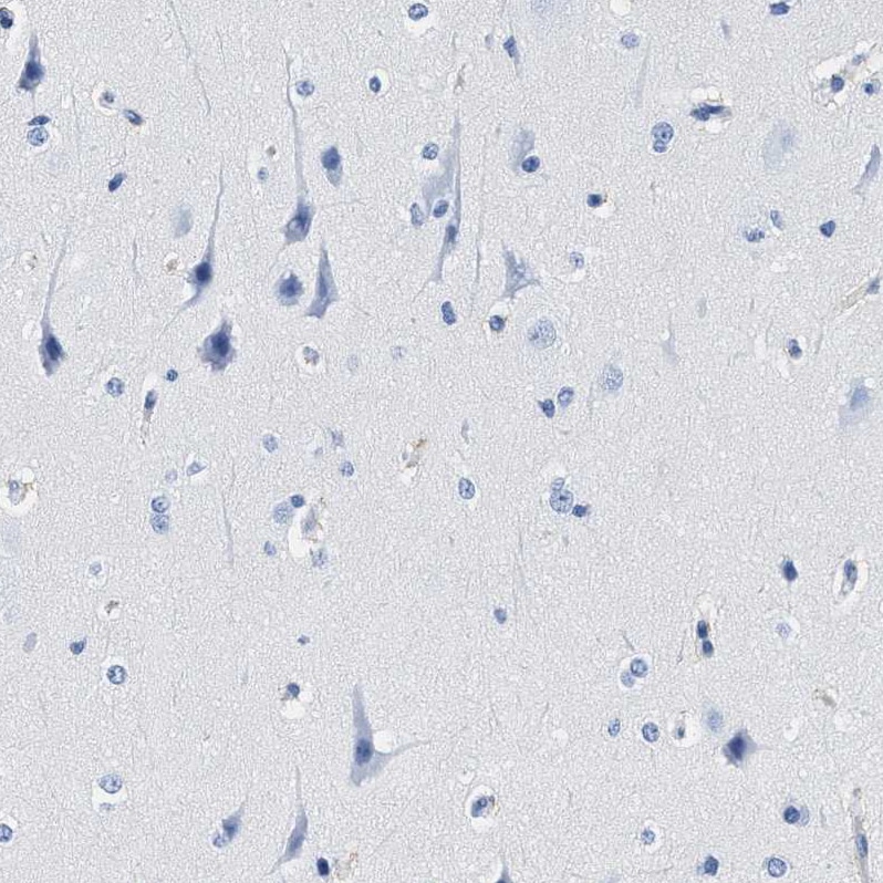 Cerberus 1 Antibody - BSA Free Immunohistochemistry-Paraffin: Cerberus 1 Antibody - BSA Free [NBP1-88030]