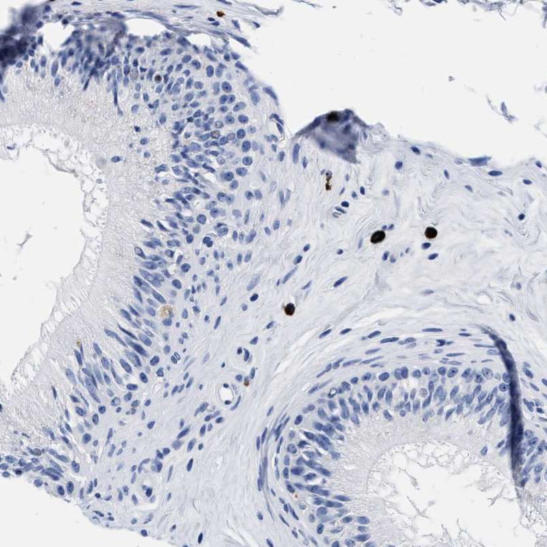 Cerberus 1 Antibody - BSA Free Immunohistochemistry-Paraffin: Cerberus 1 Antibody - BSA Free [NBP1-88030]
