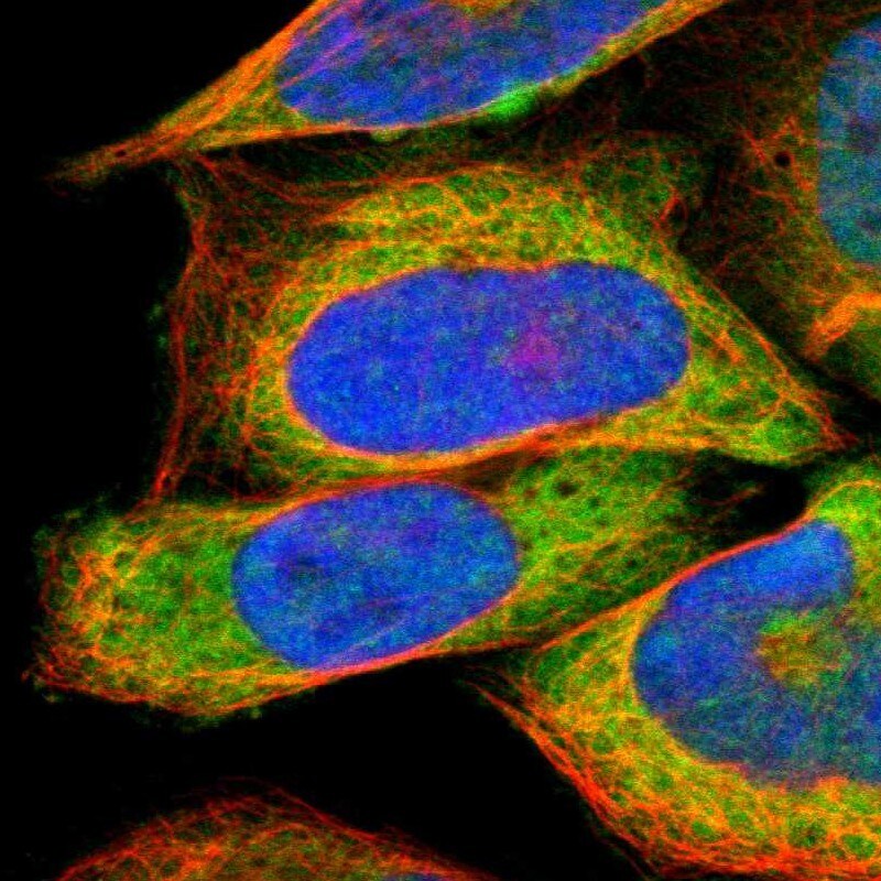 Arginyl tRNA synthetase Antibody - BSA Free Immunocytochemistry/ Immunofluorescence: Arginyl tRNA synthetase Antibody - BSA Free [NBP1-88032]