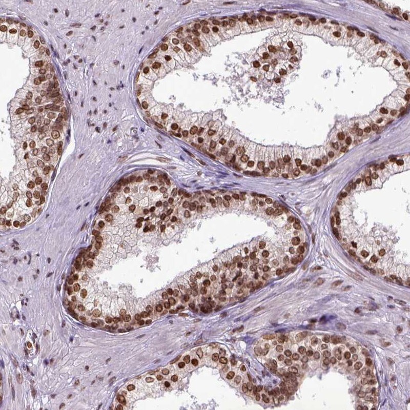 ZNF75 Antibody - BSA Free Immunohistochemistry-Paraffin: ZNF75 Antibody - BSA Free [NBP1-88035]