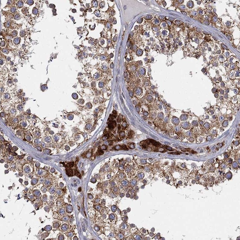 Cytochrome b5 Outer Mitochondrial Membrane Antibody - BSA Free Immunohistochemistry-Paraffin: Cytochrome b5 Outer Mitochondrial Membrane Antibody - BSA Free [NBP1-88039]
