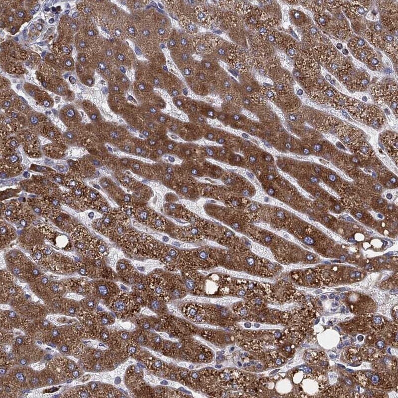 Cytochrome b5 Outer Mitochondrial Membrane Antibody - BSA Free Immunohistochemistry-Paraffin: Cytochrome b5 Outer Mitochondrial Membrane Antibody - BSA Free [NBP1-88039]