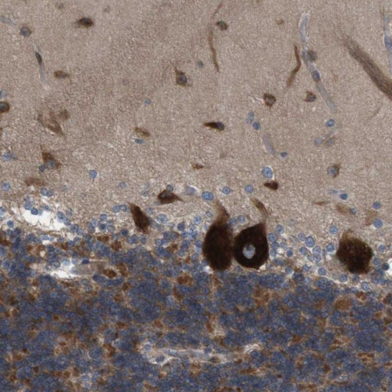 GJC3 Antibody - BSA Free Immunohistochemistry-Paraffin: GJC3 Antibody - BSA Free [NBP1-88040]