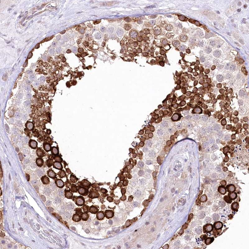 DBPA Antibody - BSA Free Immunohistochemistry-Paraffin: DBPA Antibody [NBP1-88049]