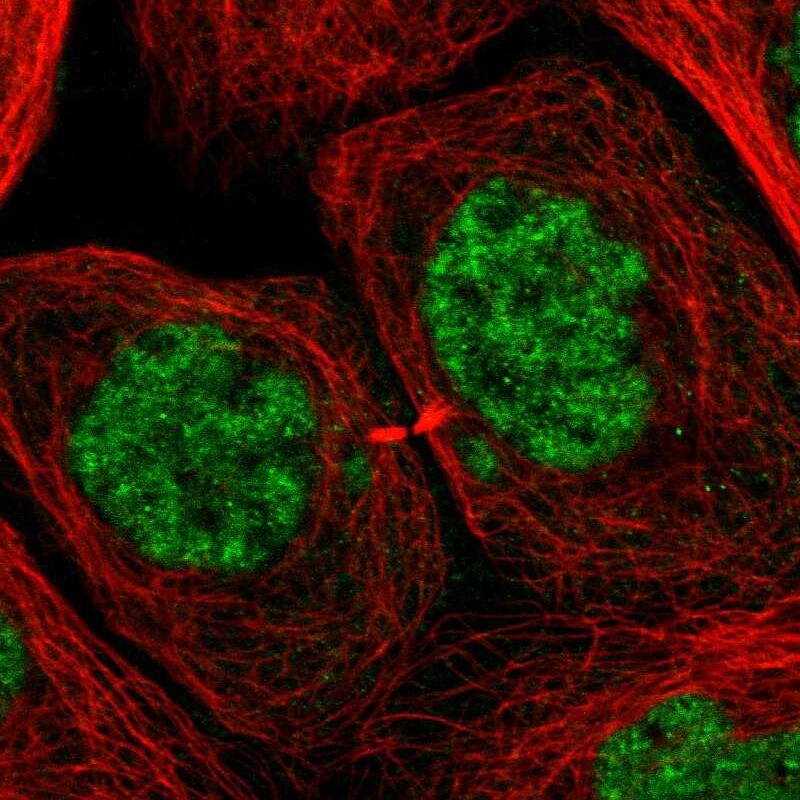 CROP Antibody - BSA Free Immunocytochemistry/ Immunofluorescence: CROP Antibody [NBP1-88051]