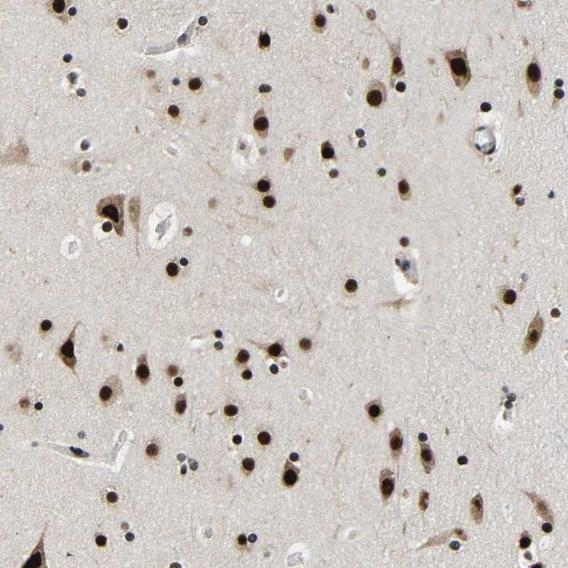 CROP Antibody - BSA Free Immunohistochemistry-Paraffin: CROP Antibody - BSA Free [NBP1-88051]