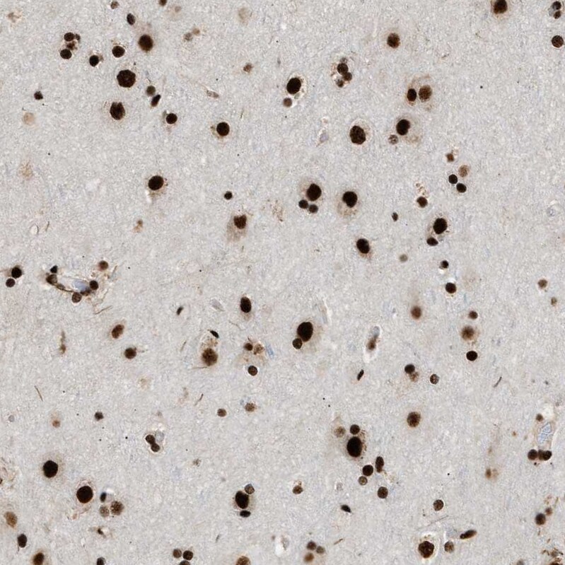 CROP Antibody - BSA Free Immunohistochemistry-Paraffin: CROP Antibody - BSA Free [NBP1-88052]
