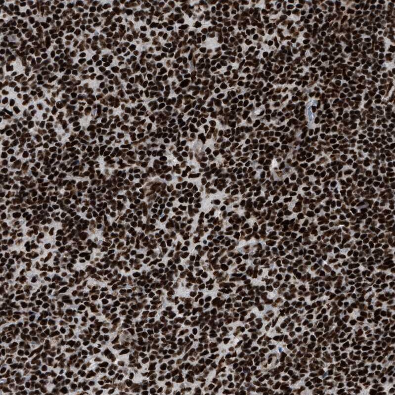 CROP Antibody - BSA Free Immunohistochemistry-Paraffin: CROP Antibody - BSA Free [NBP1-88052]