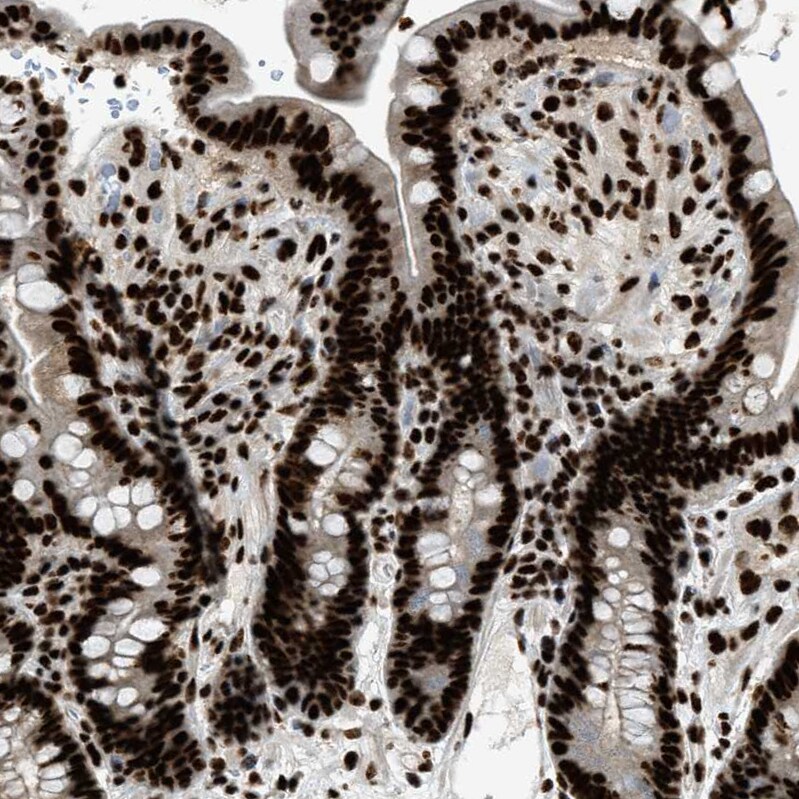 CROP Antibody - BSA Free Immunohistochemistry-Paraffin: CROP Antibody - BSA Free [NBP1-88052]