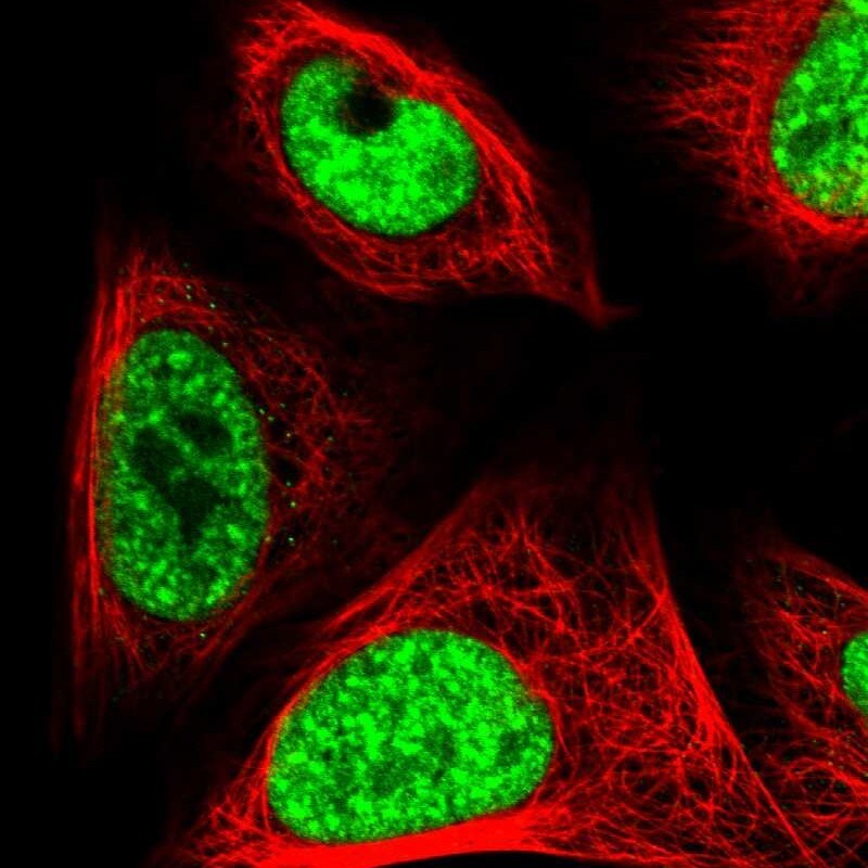 CROP Antibody - BSA Free Immunocytochemistry/ Immunofluorescence: CROP Antibody [NBP1-88053]