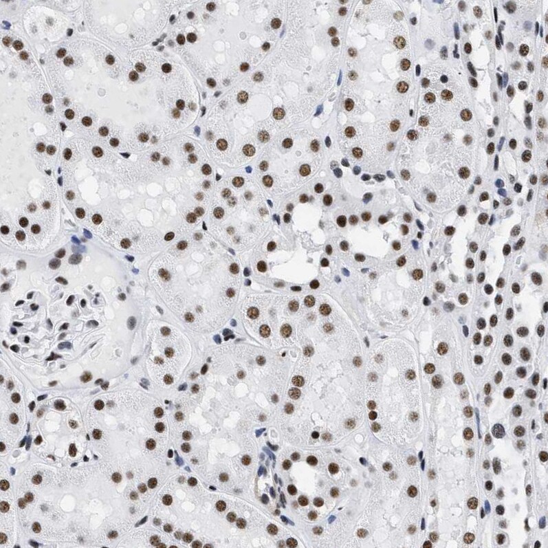 CROP Antibody - BSA Free Immunohistochemistry-Paraffin: CROP Antibody - BSA Free [NBP1-88053]