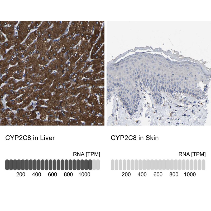 Cytochrome P450 2C8 Antibody - BSA Free Immunohistochemistry-Paraffin: Cytochrome P450 2C8 Antibody - BSA Free [NBP1-88054]