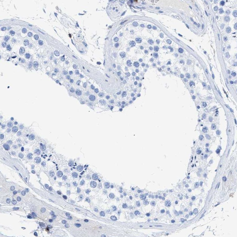 Plastin L Antibody - BSA Free Immunohistochemistry-Paraffin: Plastin L Antibody - BSA Free [NBP1-88057]