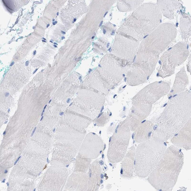 Plastin L Antibody - BSA Free Immunohistochemistry-Paraffin: Plastin L Antibody - BSA Free [NBP1-88057]