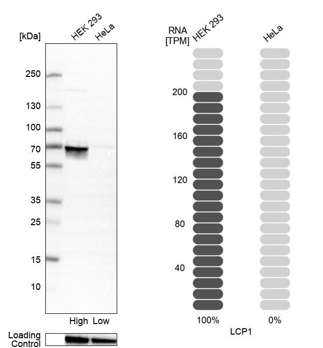Plastin L Antibody - BSA Free Western Blot: Plastin L Antibody - BSA Free [NBP1-88057]