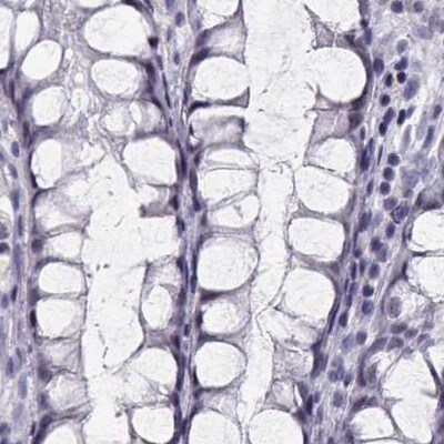 CRX/CORD2 Antibody - BSA Free Immunohistochemistry-Paraffin: CRX/CORD2 Antibody - BSA Free [NBP1-88059]
