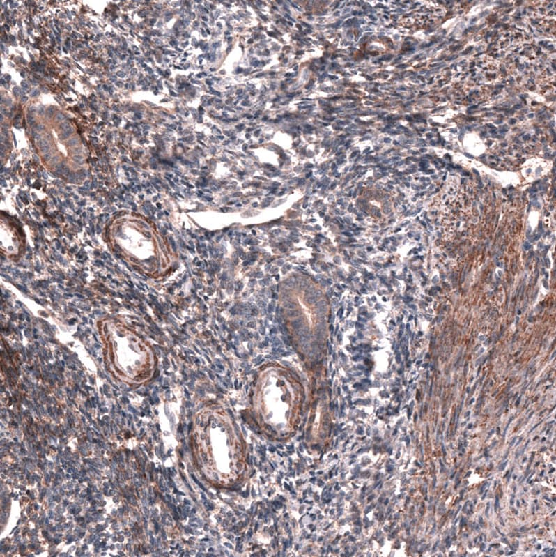 Collagen XII alpha1 Antibody - BSA Free Immunohistochemistry-Paraffin: Collagen XII alpha1 Antibody - BSA Free [NBP1-88062]