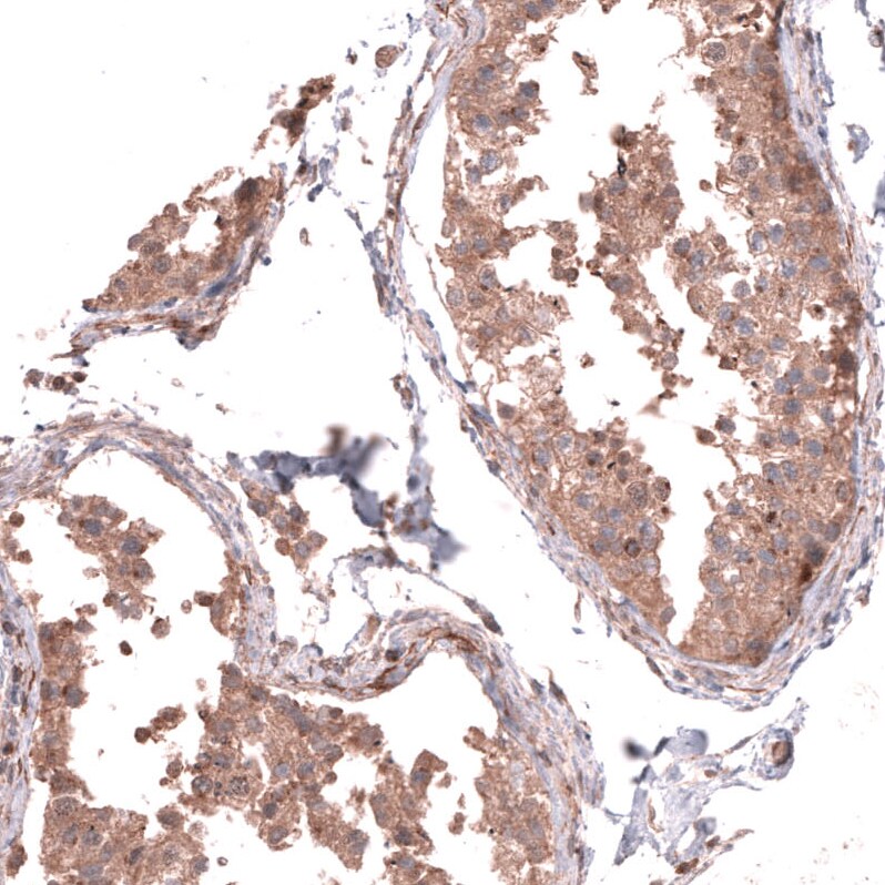 Collagen XII alpha1 Antibody - BSA Free Immunohistochemistry-Paraffin: Collagen XII alpha1 Antibody - BSA Free [NBP1-88062]
