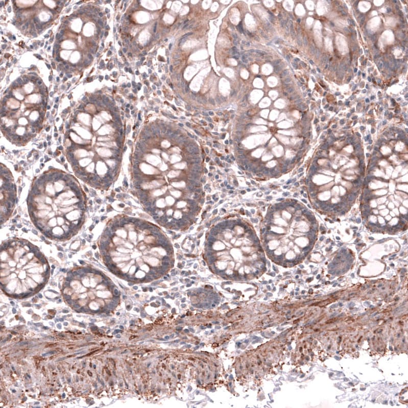 Collagen XII alpha1 Antibody - BSA Free Immunohistochemistry-Paraffin: Collagen XII alpha1 Antibody - BSA Free [NBP1-88062]