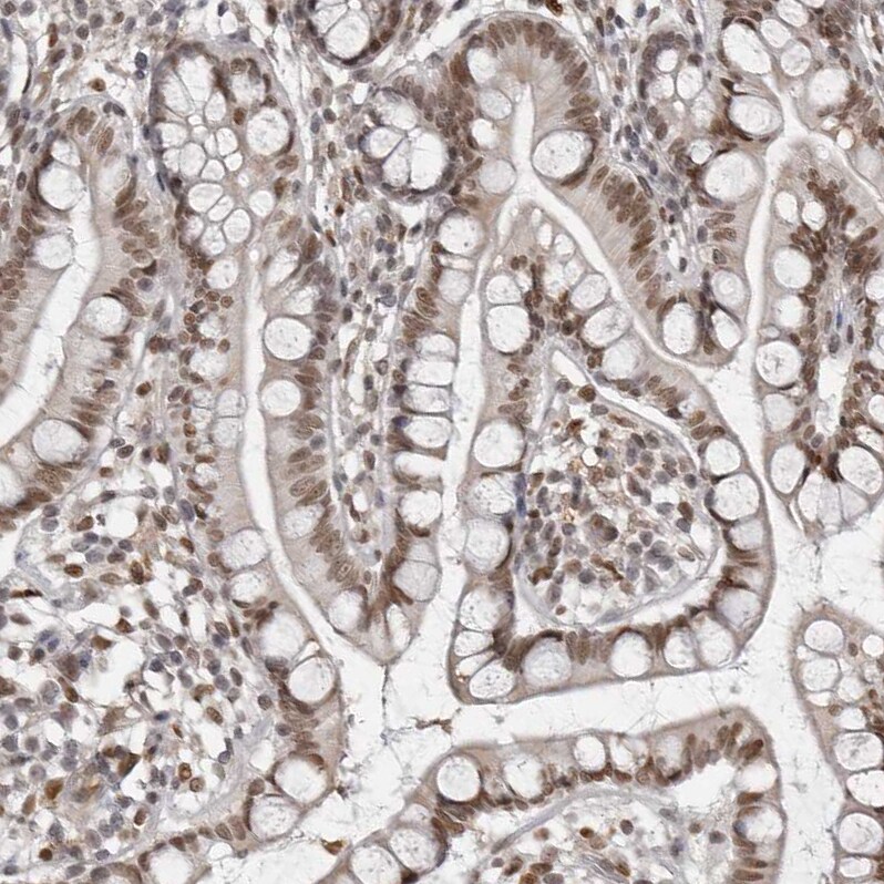 c-Maf Antibody - BSA Free Immunohistochemistry-Paraffin: c-Maf Antibody - BSA Free [NBP1-88072]
