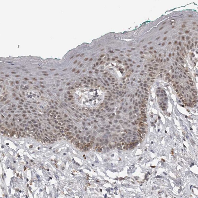 c-Maf Antibody - BSA Free Immunohistochemistry-Paraffin: c-Maf Antibody - BSA Free [NBP1-88072]