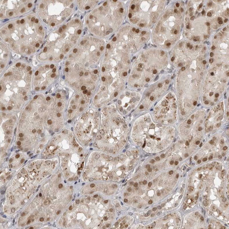 c-Maf Antibody - BSA Free Immunohistochemistry-Paraffin: c-Maf Antibody - BSA Free [NBP1-88072]