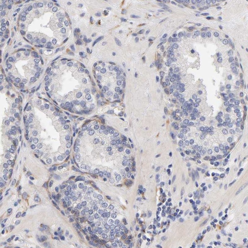 Laminin beta 1 Antibody - BSA Free Immunohistochemistry-Paraffin: Laminin beta 1 Antibody [NBP1-88073]