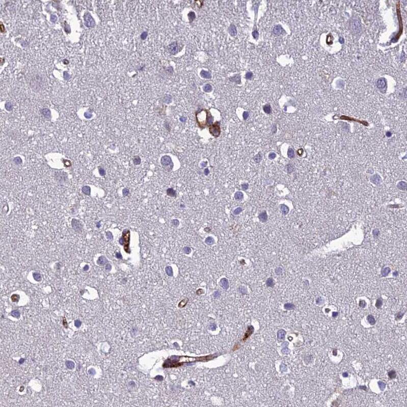 SCGF/CLEC11a Antibody - BSA Free Immunohistochemistry-Paraffin: SCGF/CLEC11a Antibody - BSA Free [NBP1-88076]