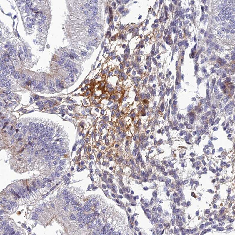 SCGF/CLEC11a Antibody - BSA Free Immunohistochemistry-Paraffin: SCGF/CLEC11a Antibody - BSA Free [NBP1-88076]
