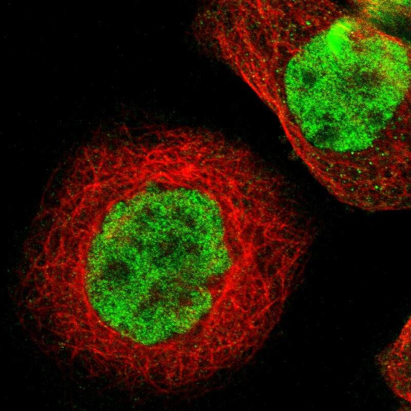 Th-POK Antibody - BSA Free Immunocytochemistry/ Immunofluorescence: Th-POK Antibody [NBP1-88077]