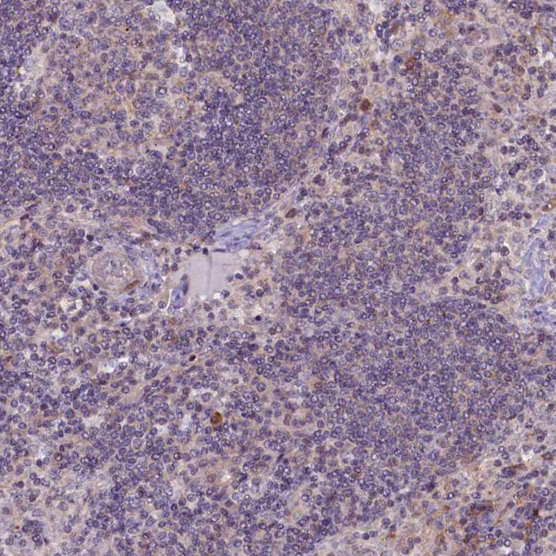 CCL23/Ck beta 8-1/MIP3 Antibody - BSA Free Immunohistochemistry-Paraffin: CCL23/Ck beta 8-1/MIP3 Antibody - BSA Free [NBP1-88079]