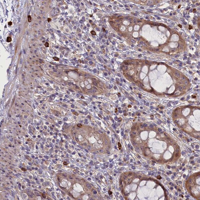 CCL23/Ck beta 8-1/MIP3 Antibody - BSA Free Immunohistochemistry-Paraffin: CCL23/Ck beta 8-1/MIP3 Antibody - BSA Free [NBP1-88079]