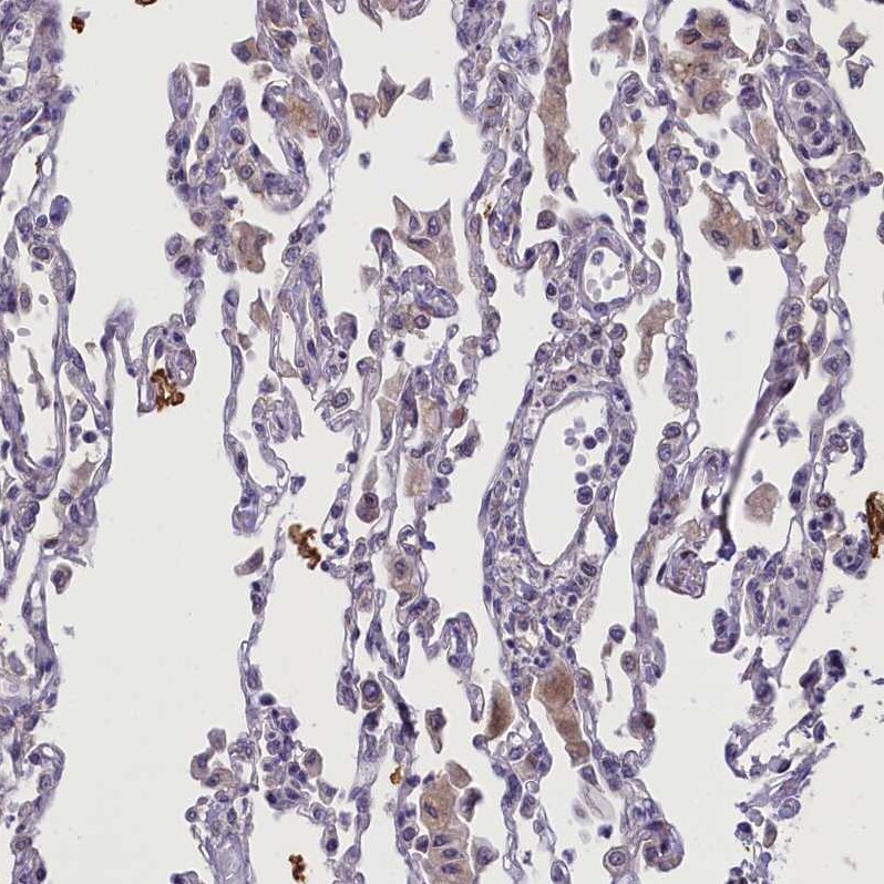CCL23/Ck beta 8-1/MIP3 Antibody - BSA Free Immunohistochemistry-Paraffin: CCL23/Ck beta 8-1/MIP3 Antibody - BSA Free [NBP1-88079]