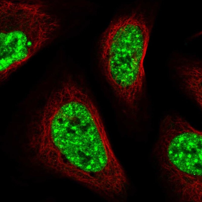 CIP29 Antibody - BSA Free Immunocytochemistry/ Immunofluorescence: CIP29 Antibody [NBP1-88084]