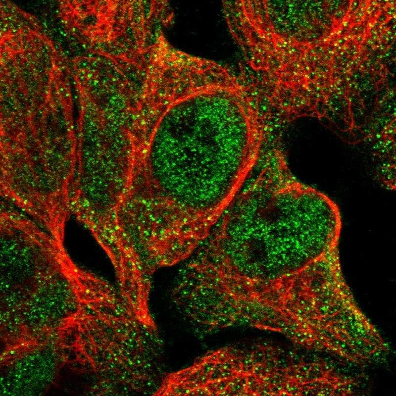 CSGLCAT Antibody - BSA Free Immunocytochemistry/ Immunofluorescence: CSGLCAT Antibody - BSA Free [NBP1-88086]