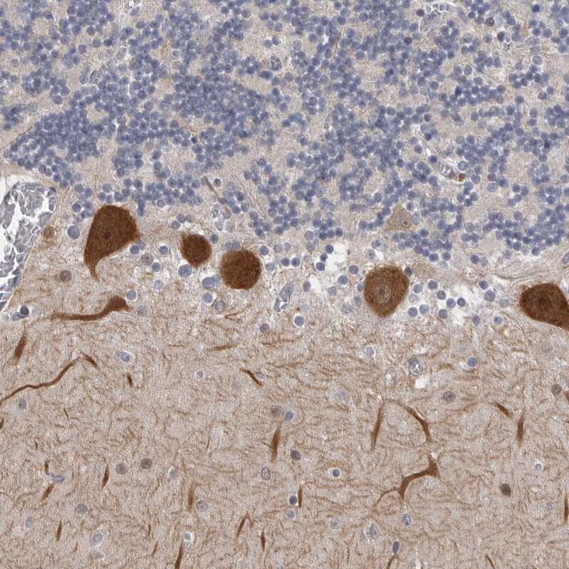 PSD93 Antibody - BSA Free Immunohistochemistry-Paraffin: PSD93 Antibody [NBP1-88088]