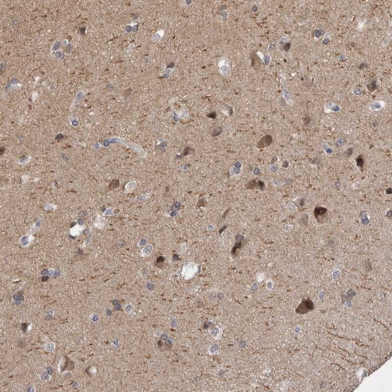 PSD93 Antibody - BSA Free Immunohistochemistry-Paraffin: PSD93 Antibody [NBP1-88088]