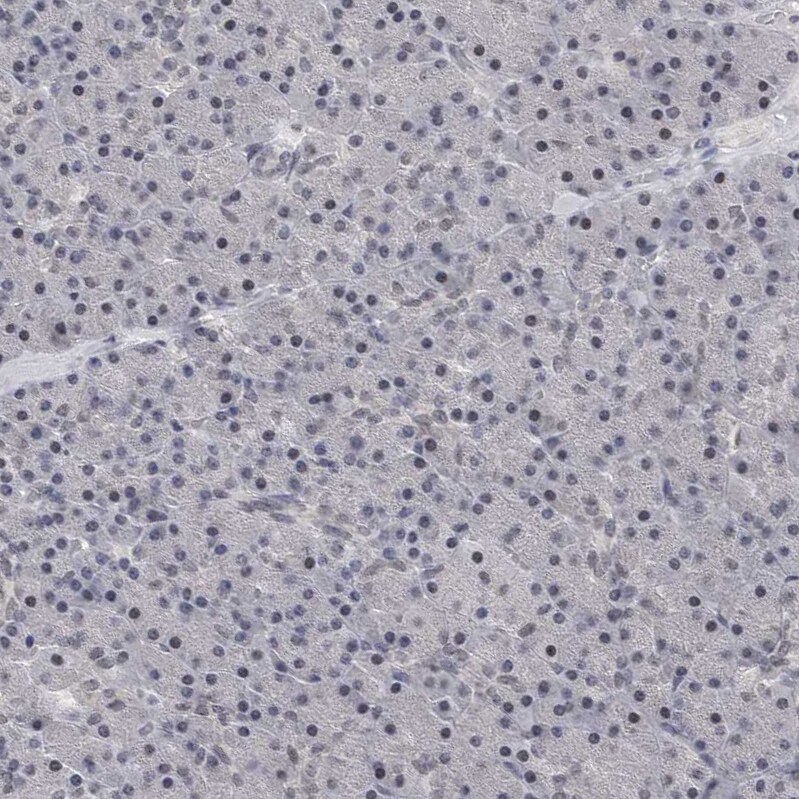 PSD93 Antibody - BSA Free Immunohistochemistry-Paraffin: PSD93 Antibody [NBP1-88088]